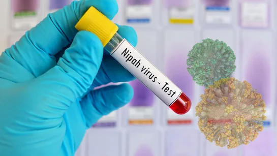 Nipah-Virus-Ausbruch in Indien 2026